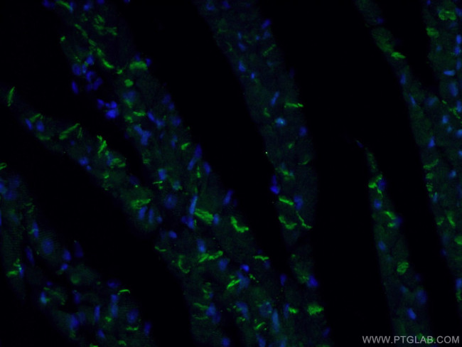 Desmocollin 2 Antibody in Immunohistochemistry (PFA fixed) (IHC (PFA))