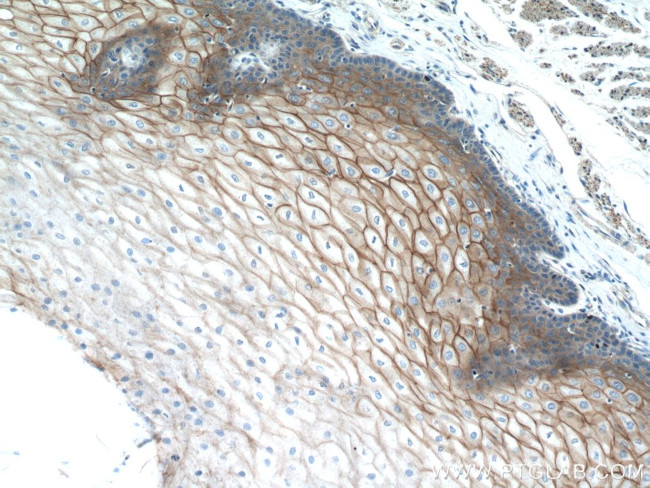 Desmocollin 2 Antibody in Immunohistochemistry (Paraffin) (IHC (P))