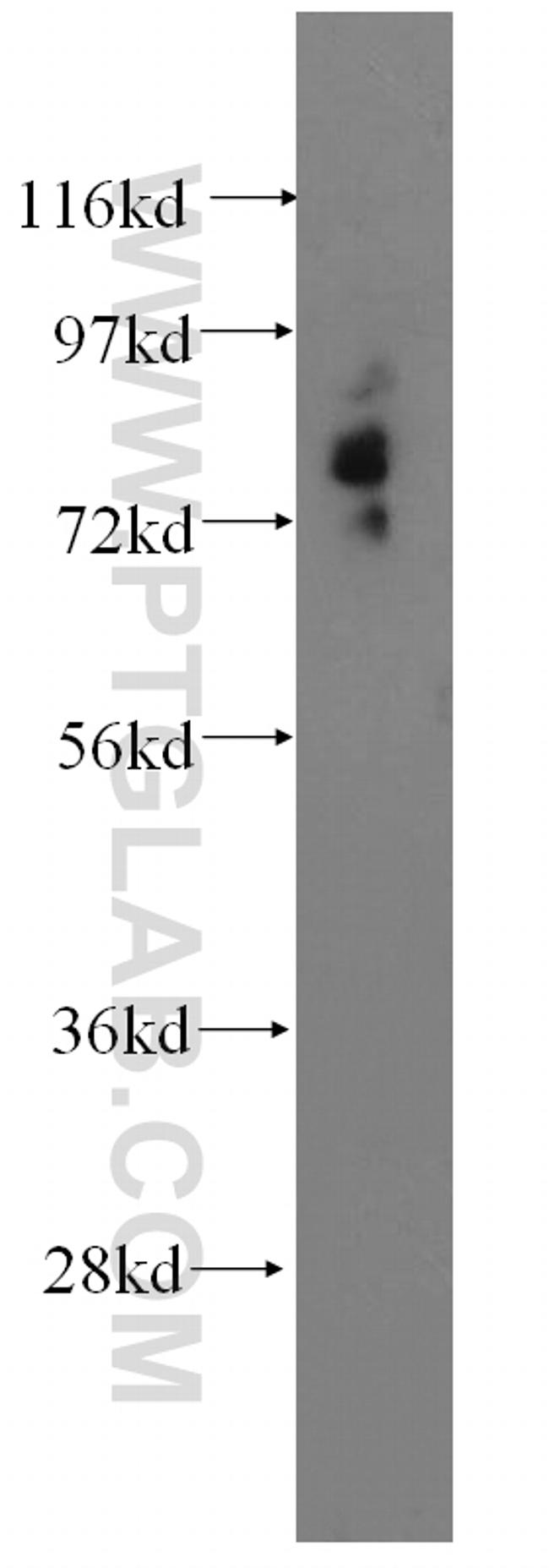 Mucolipin 3 Antibody in Western Blot (WB)