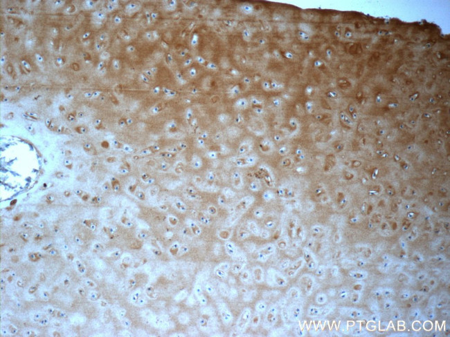 Aggrecan Antibody in Immunohistochemistry (Paraffin) (IHC (P))