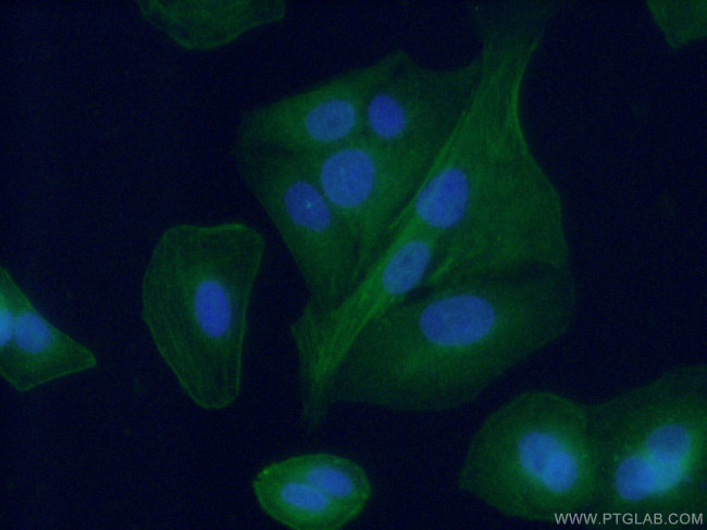 Aggrecan Antibody in Immunocytochemistry (ICC/IF)