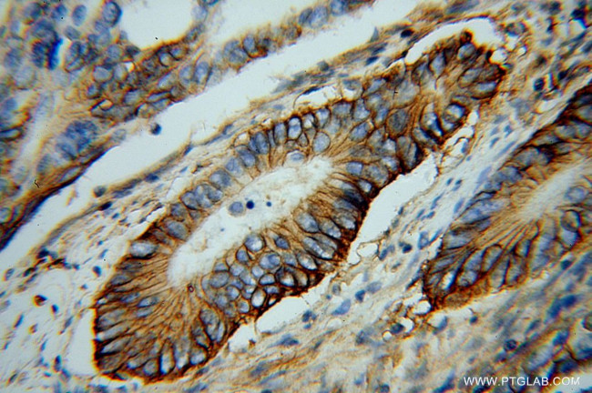 NKCC1 Antibody in Immunohistochemistry (Paraffin) (IHC (P))