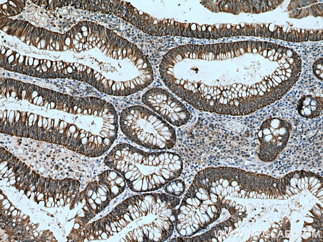 NKCC1 Antibody in Immunohistochemistry (Paraffin) (IHC (P))