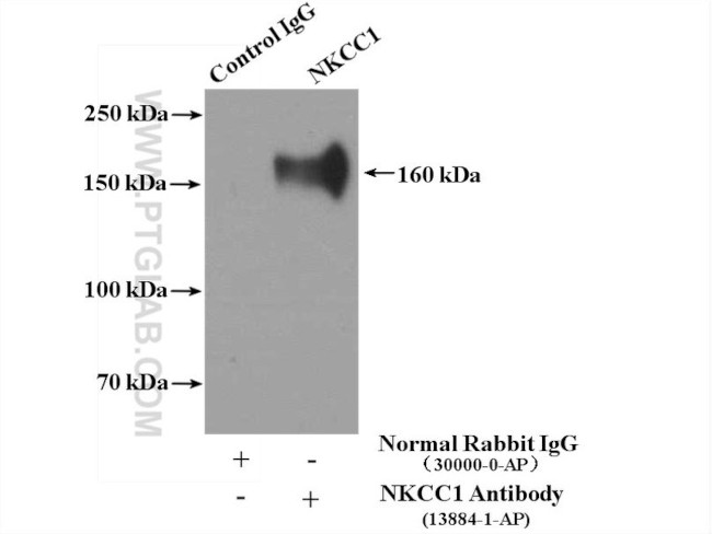 NKCC1 Antibody in Immunoprecipitation (IP)