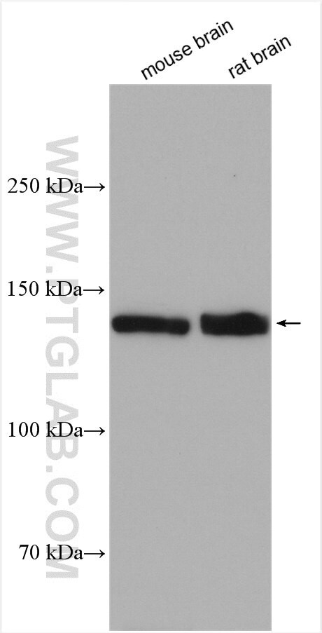 NKCC1 Antibody in Western Blot (WB)