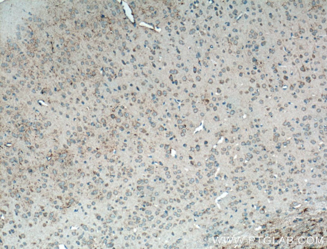 CX3CR1 Antibody in Immunohistochemistry (Paraffin) (IHC (P))