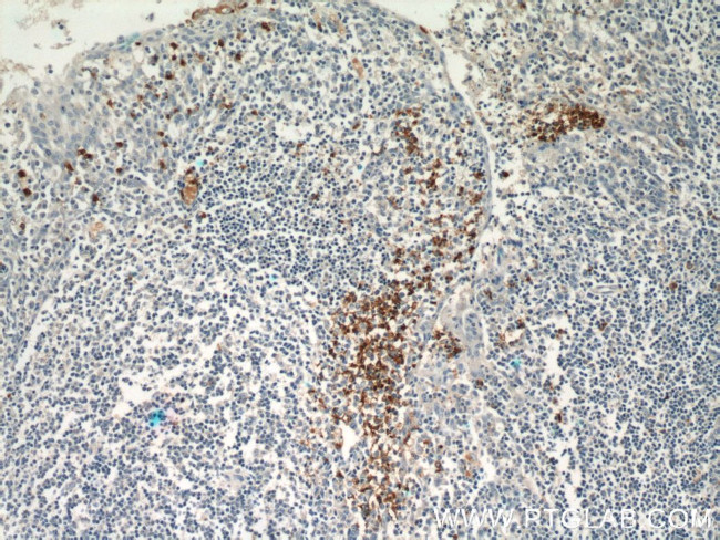 CX3CR1 Antibody in Immunohistochemistry (Paraffin) (IHC (P))