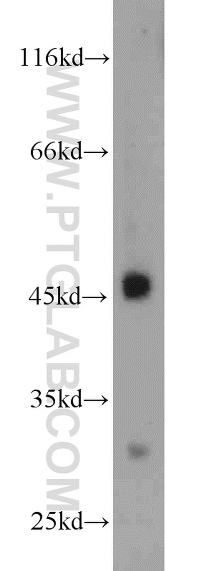 CX3CR1 Antibody in Western Blot (WB)