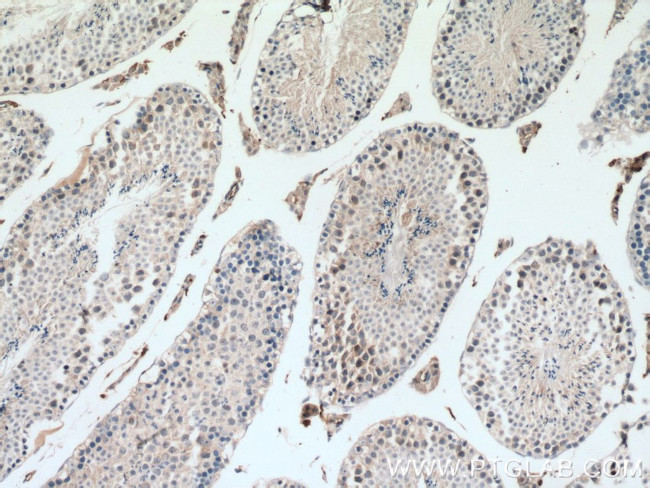 SIAH1 Antibody in Immunohistochemistry (Paraffin) (IHC (P))