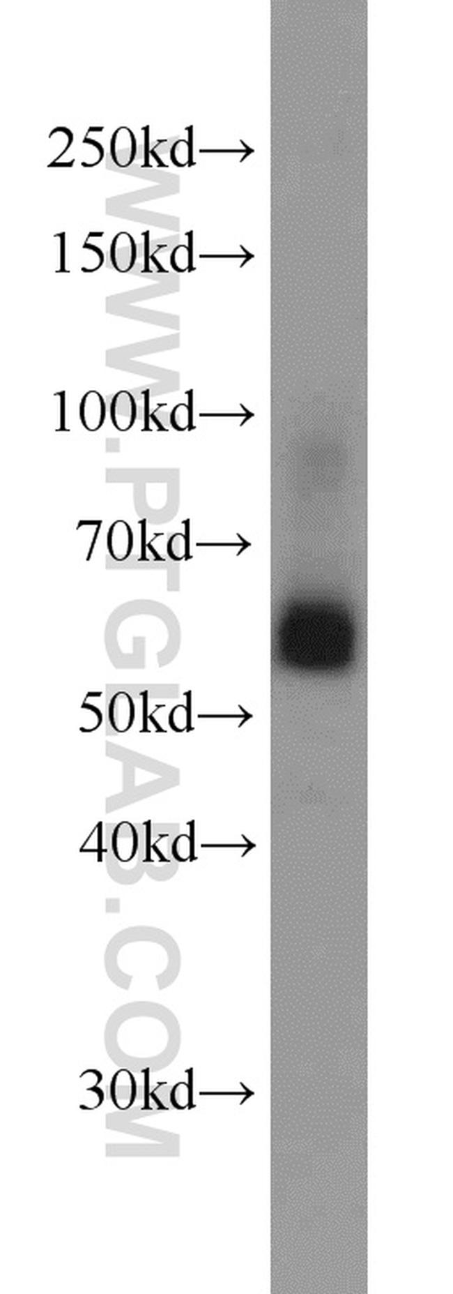 SIAH1 Antibody in Western Blot (WB)