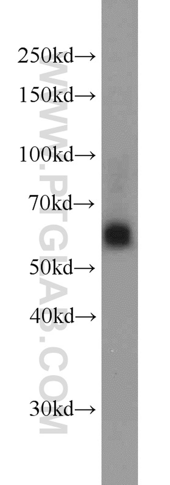 SIAH1 Antibody in Western Blot (WB)