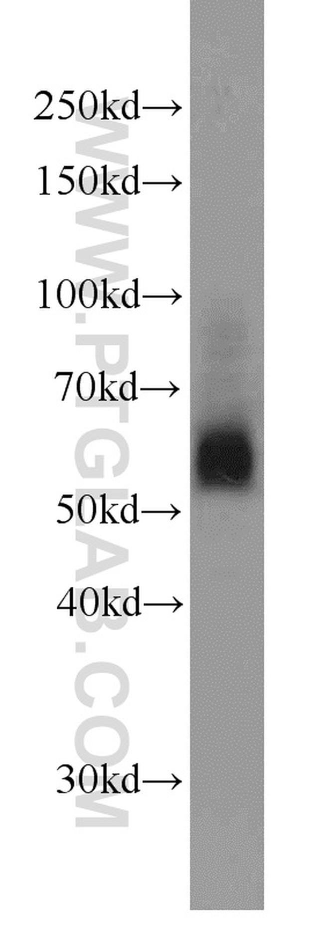 SIAH1 Antibody in Western Blot (WB)