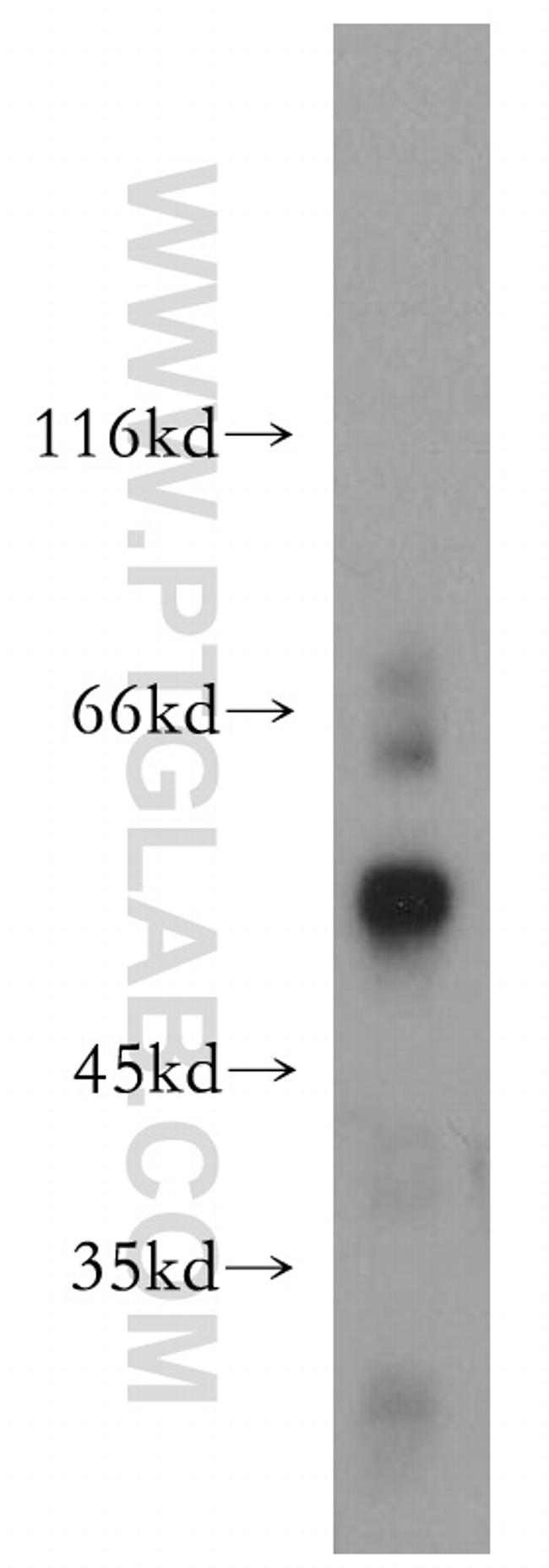 SIAH1 Antibody in Western Blot (WB)