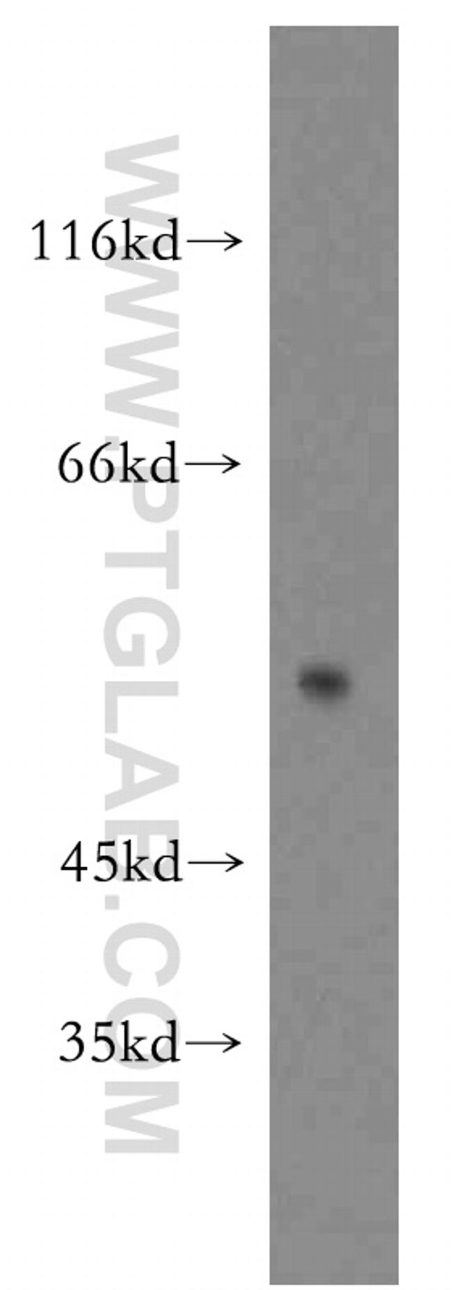 SIAH1 Antibody in Western Blot (WB)