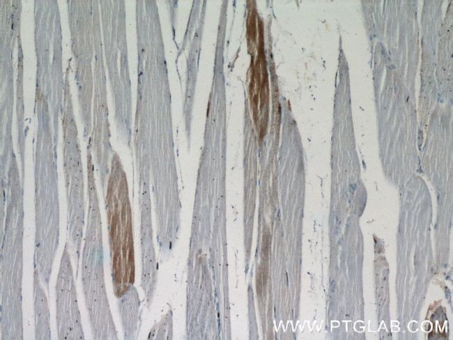 NDUFAF2 Antibody in Immunohistochemistry (Paraffin) (IHC (P))