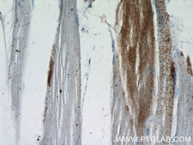 NDUFAF2 Antibody in Immunohistochemistry (Paraffin) (IHC (P))