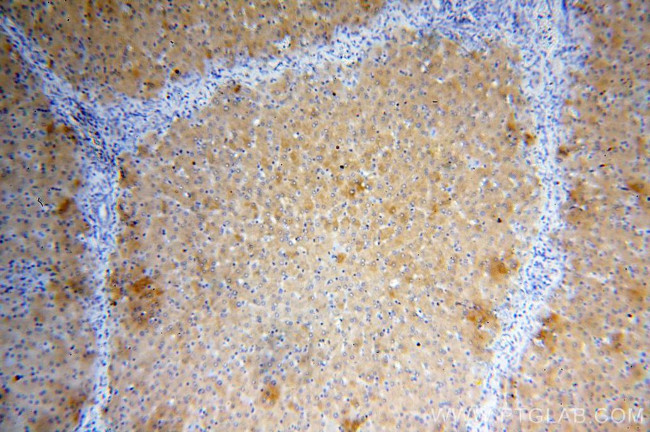 NDUFAF2 Antibody in Immunohistochemistry (Paraffin) (IHC (P))