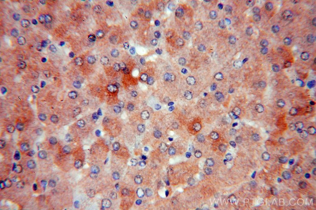 NDUFAF2 Antibody in Immunohistochemistry (Paraffin) (IHC (P))