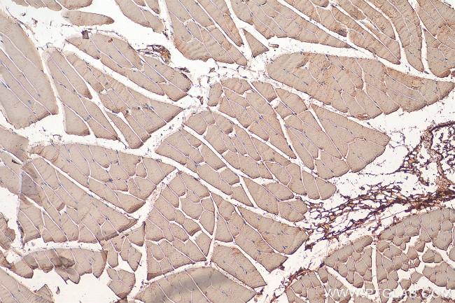 NDUFAF2 Antibody in Immunohistochemistry (Paraffin) (IHC (P))