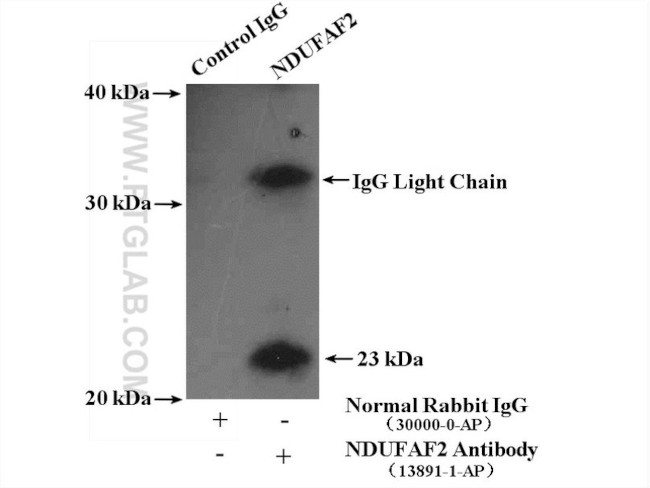 NDUFAF2 Antibody in Immunoprecipitation (IP)