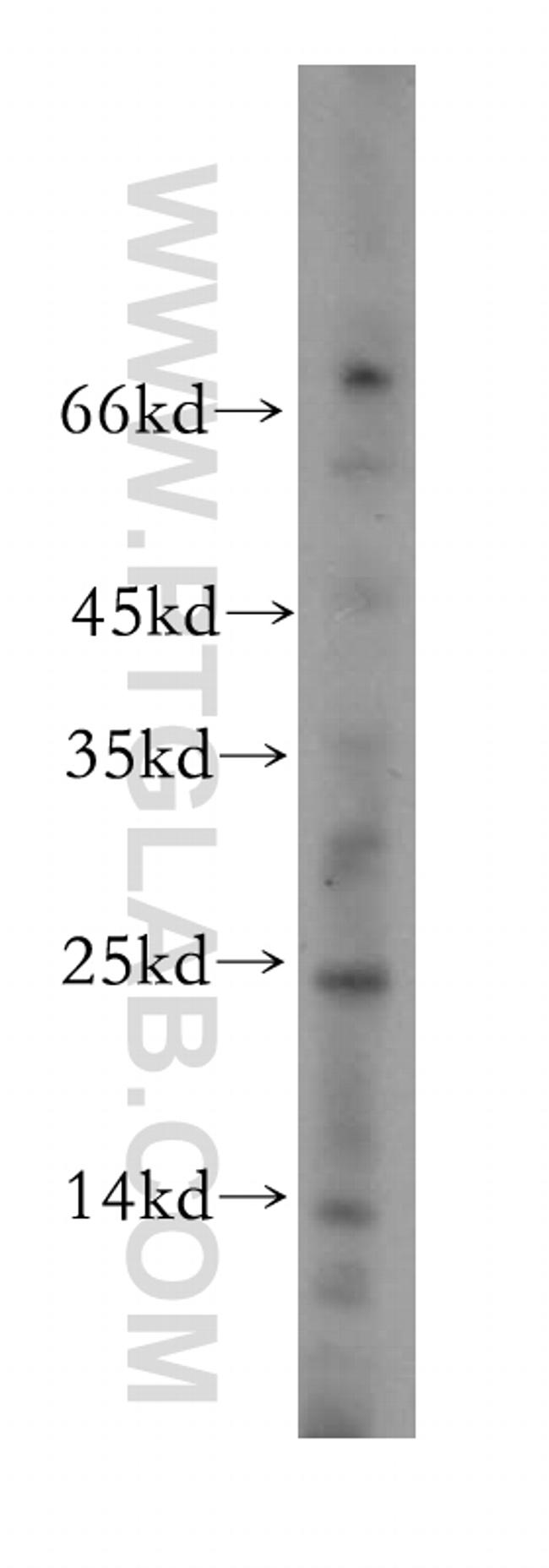 NDUFAF2 Antibody in Western Blot (WB)