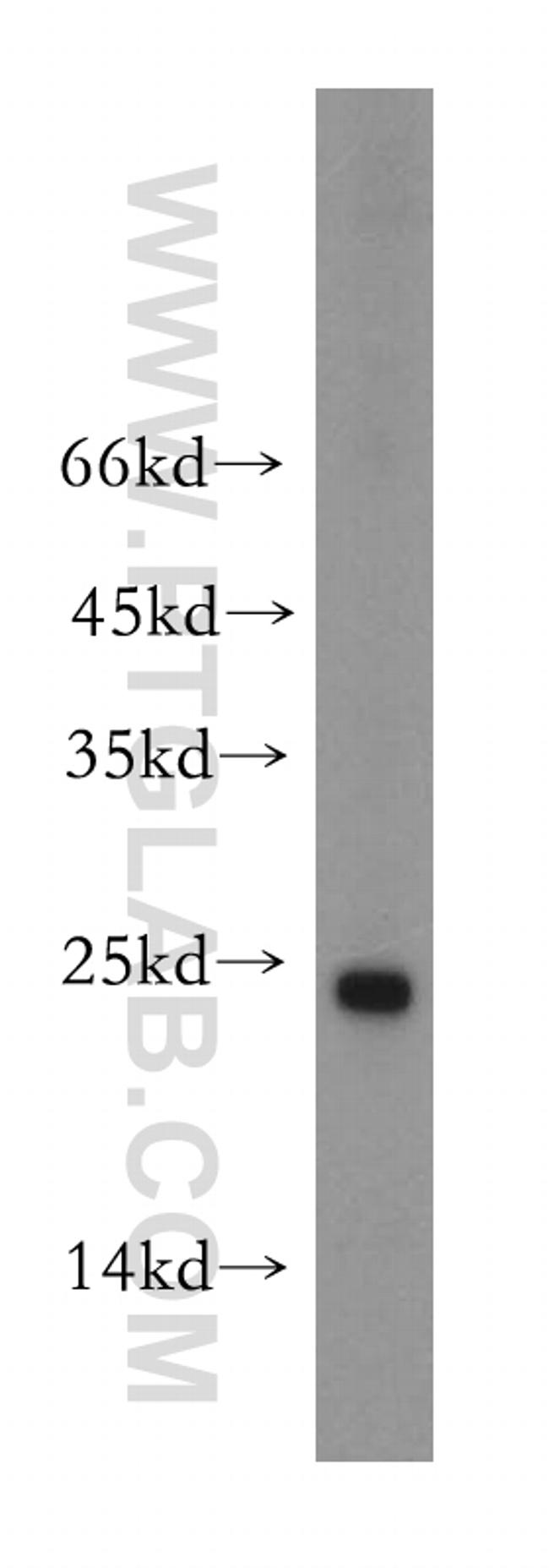 NDUFAF2 Antibody in Western Blot (WB)