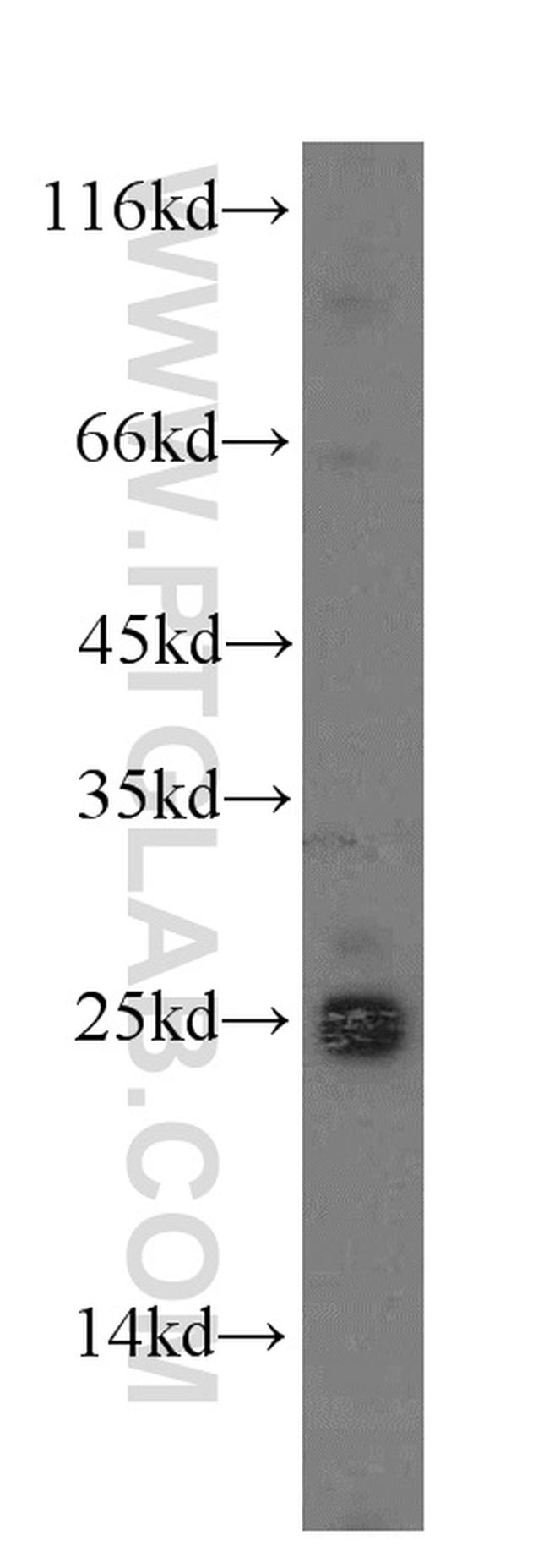 NDUFAF2 Antibody in Western Blot (WB)