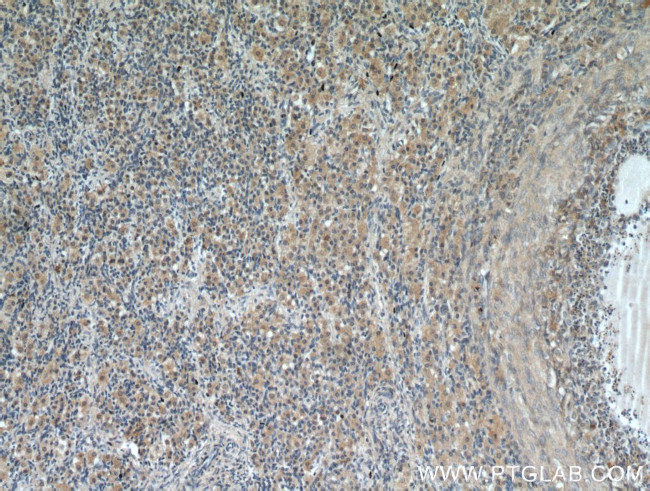 GREM2 Antibody in Immunohistochemistry (Paraffin) (IHC (P))