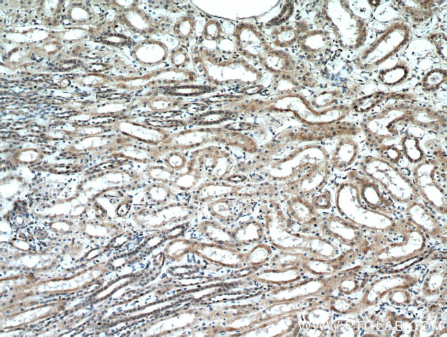 GREM2 Antibody in Immunohistochemistry (Paraffin) (IHC (P))