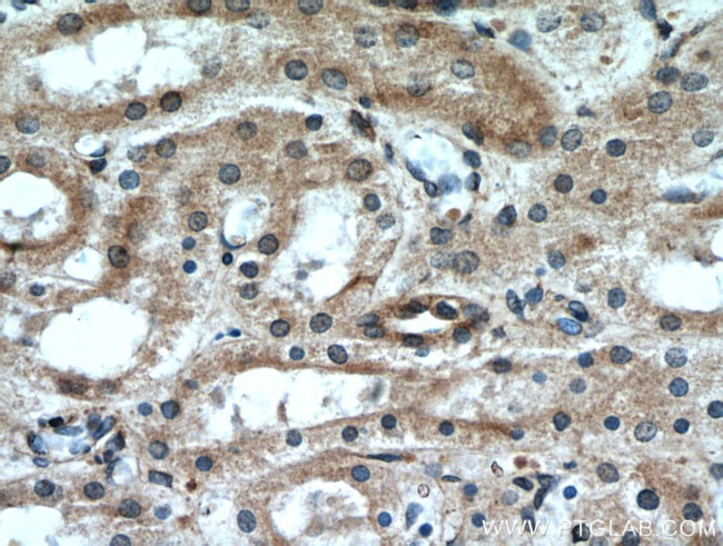 GREM2 Antibody in Immunohistochemistry (Paraffin) (IHC (P))