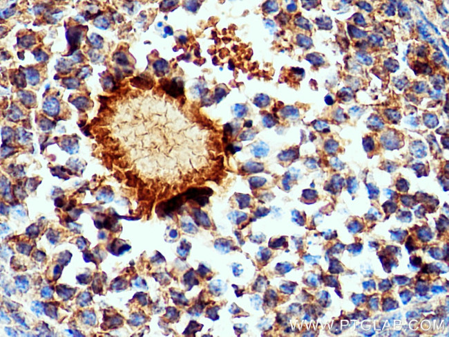 GREM2 Antibody in Immunohistochemistry (Paraffin) (IHC (P))