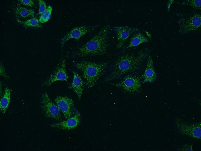 Synaptojanin 2 Antibody in Immunocytochemistry (ICC/IF)