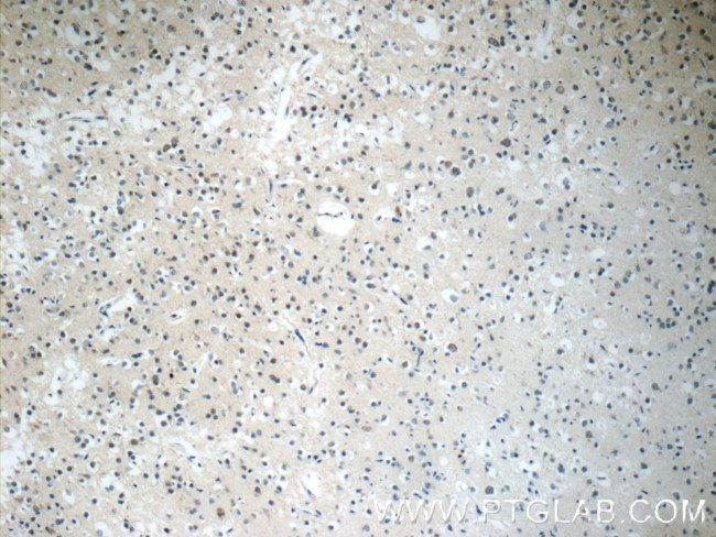 Synaptojanin 2 Antibody in Immunohistochemistry (Paraffin) (IHC (P))