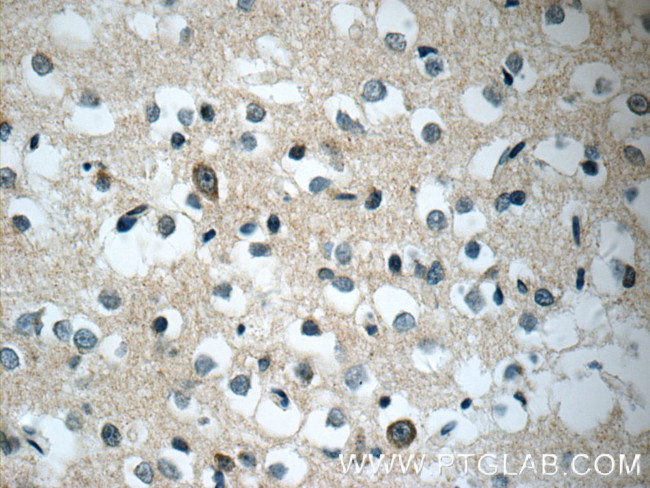 Synaptojanin 2 Antibody in Immunohistochemistry (Paraffin) (IHC (P))