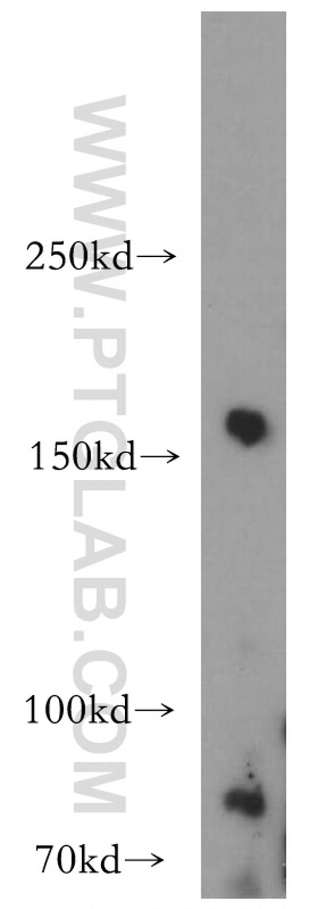 Synaptojanin 2 Antibody in Western Blot (WB)