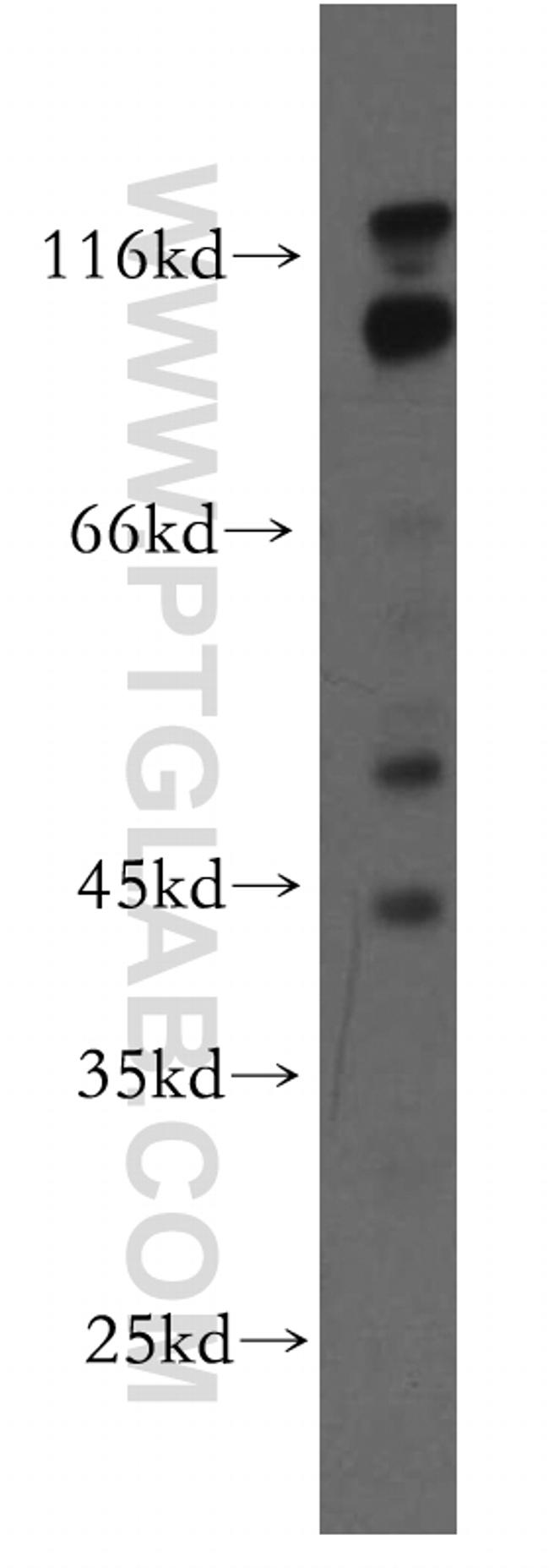 RABGAP1L Antibody in Western Blot (WB)