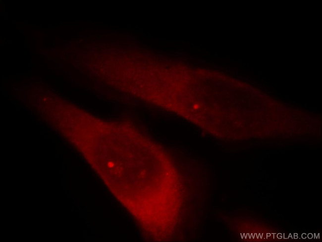 RABGAP1L Antibody in Immunocytochemistry (ICC/IF)