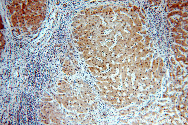 RABGAP1L Antibody in Immunohistochemistry (Paraffin) (IHC (P))