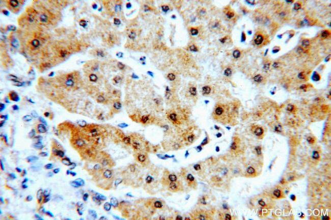 RABGAP1L Antibody in Immunohistochemistry (Paraffin) (IHC (P))