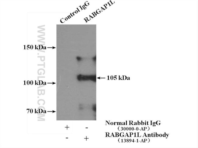 RABGAP1L Antibody in Immunoprecipitation (IP)