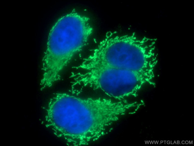 D2HGDH Antibody in Immunocytochemistry (ICC/IF)