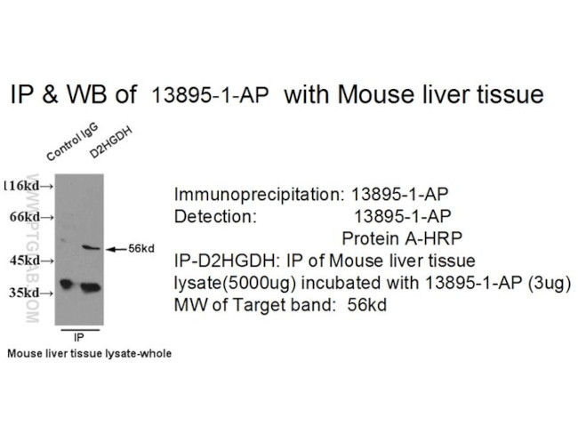 D2HGDH Antibody in Immunoprecipitation (IP)