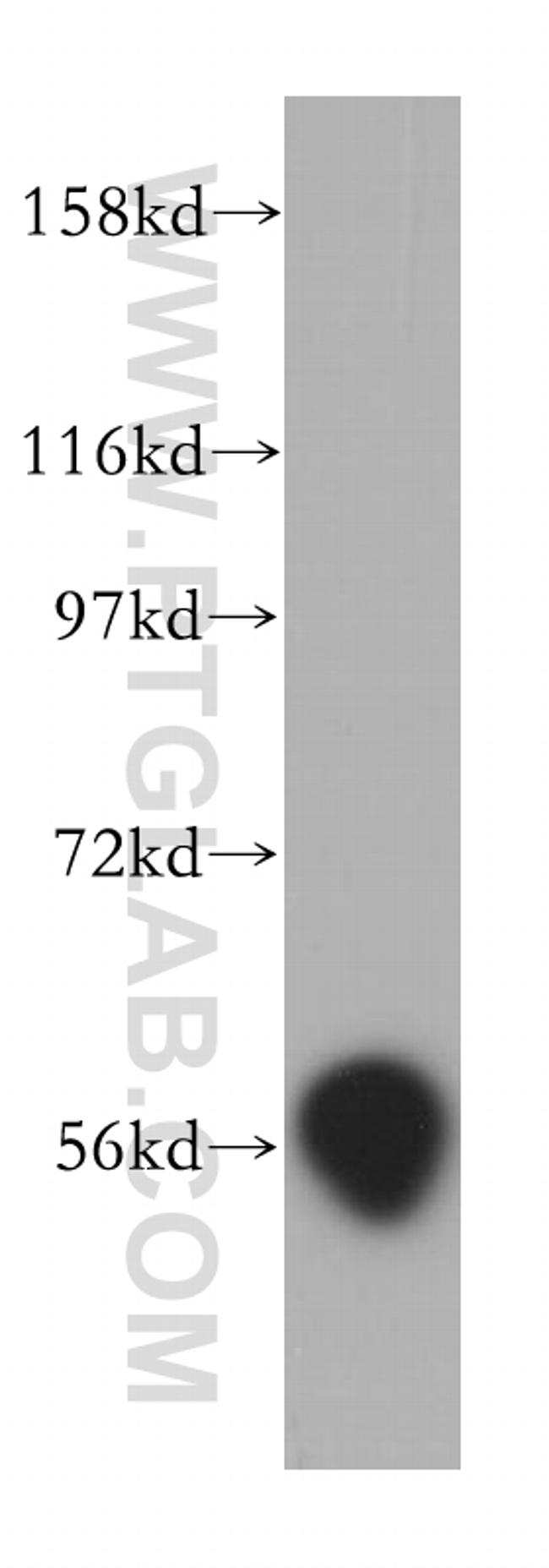 D2HGDH Antibody in Western Blot (WB)