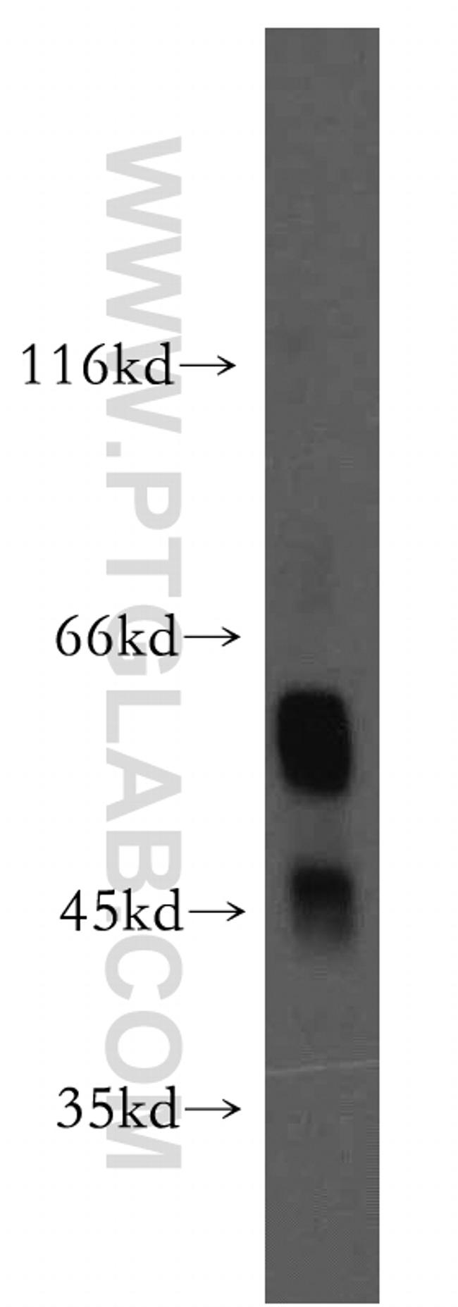 D2HGDH Antibody in Western Blot (WB)