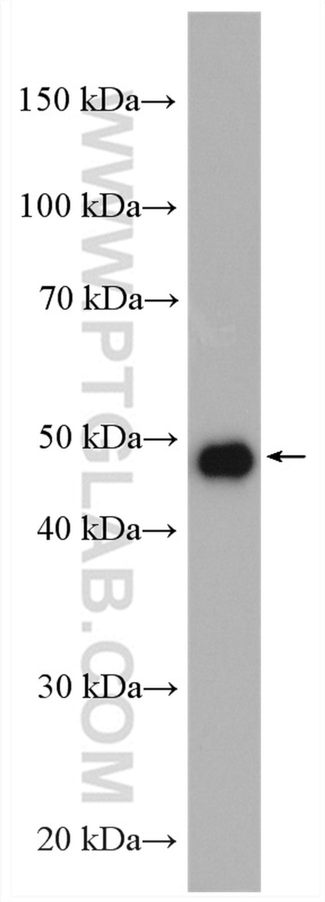 D2HGDH Antibody in Western Blot (WB)