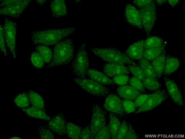 GTPBP4 Antibody in Immunocytochemistry (ICC/IF)