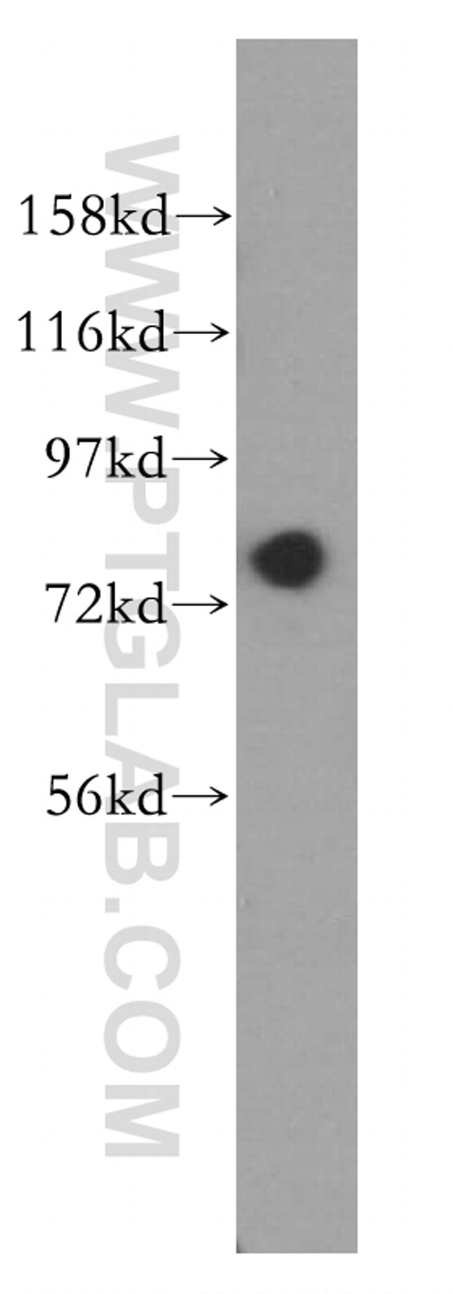 GTPBP4 Antibody in Western Blot (WB)