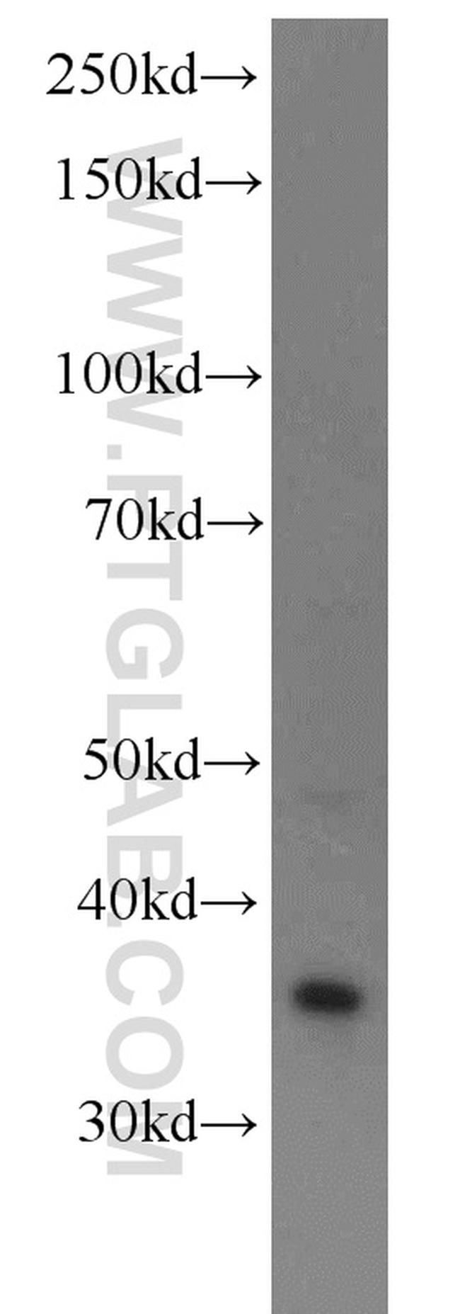 MEK3 Antibody in Western Blot (WB)