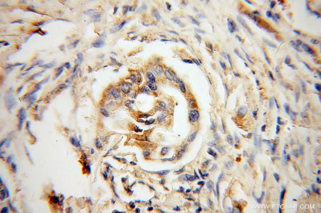 DHDH Antibody in Immunohistochemistry (Paraffin) (IHC (P))