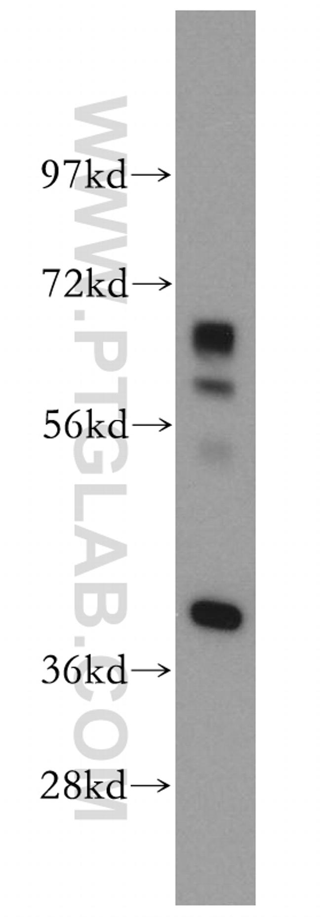 DHDH Antibody in Western Blot (WB)